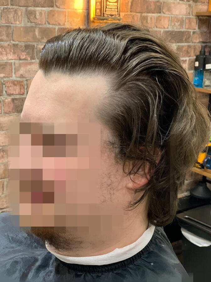 Before Before